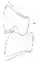 Fig. 01 - ARTIFICIAL TOOTH, A JIG FOR ARRANGING THE SAME, AN ARRANGEMENT METHOD OF THE SAME AND A DENTURE