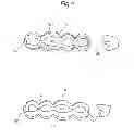 Fig. 09 - ARTIFICIAL TOOTH, A JIG FOR ARRANGING THE SAME, AN ARRANGEMENT METHOD OF THE SAME AND A DENTURE