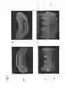 Fig. 12 - ARTIFICIAL TOOTH, A JIG FOR ARRANGING THE SAME, AN ARRANGEMENT METHOD OF THE SAME AND A DENTURE