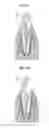 Fig. 03 - Root canal filling material containing mesenchymal stem cells and method for regenerating dental tissue using the same