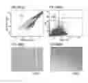 Fig. 10 - Root canal filling material containing mesenchymal stem cells and method for regenerating dental tissue using the same