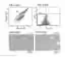 Fig. 17 - Root canal filling material containing mesenchymal stem cells and method for regenerating dental tissue using the same