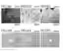 Fig. 20 - Root canal filling material containing mesenchymal stem cells and method for regenerating dental tissue using the same