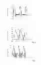 Fig. 04 - SYSTEM FOR EVALUATING CARDIAC SURGERY TRAINING