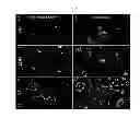 Fig. 06 - COMPOSITIONS AND METHODS FOR DETECTION OF DEFENSINS IN A PATIENT SAMPLE