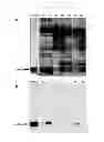 Fig. 07 - COMPOSITIONS AND METHODS FOR DETECTION OF DEFENSINS IN A PATIENT SAMPLE