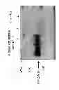 Fig. 04 - Method for producing virus vector for gene transfer