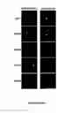 Fig. 09 - Lipid Production