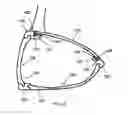 Fig. 07 - Golf club head comprising multiple materials