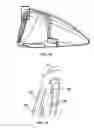 Fig. 11 - Golf club head comprising multiple materials