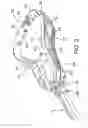 Fig. 03 - Lacrosse stick head