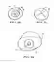 Fig. 06 - Climbing hold assembly having load dissipative effect