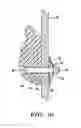 Fig. 09 - Climbing hold assembly having load dissipative effect