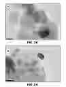 Fig. 04 - SUPPORTED METAL CATALYST AND METHOD OF MAKING THE CATALYST