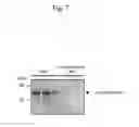 Fig. 08 - Method for Enrichment and Separation of Spinal Fluid Glycoprotein, Method for Searching for Marker for Central Nervous System Diseases Which Utilizes the Aforementioned Method, and Marker for Central Nervous System Diseases