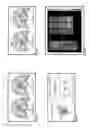 Fig. 02 - Methods of novel therapeutic candidate identification through gene expression analysis in vascular related diseases