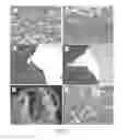 Fig. 02 - Differential identification of pancreatic cysts