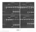 Fig. 05 - Differential identification of pancreatic cysts