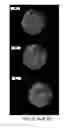 Fig. 13 - CELL-BASED ARRAYS, METHODS OF MAKING, AND METHODS OF USING