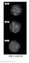 Fig. 15 - CELL-BASED ARRAYS, METHODS OF MAKING, AND METHODS OF USING