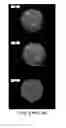 Fig. 16 - CELL-BASED ARRAYS, METHODS OF MAKING, AND METHODS OF USING
