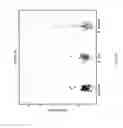 Fig. 25 - Biomarkers for the molecular classification of bacterial infection