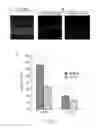 Fig. 02 - Methods for preserving photoreceptor cell viability following retinal detachment