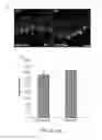 Fig. 05 - Methods for preserving photoreceptor cell viability following retinal detachment