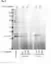 Fig. 05 - BETA-O/S/N FATTY ACID BASED COMPOUNDS AS ANTIBACTERIAL AND ANTIPROTOZOAL AGENTS