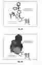 Fig. 09 - Chemotherapeutic compositions and methods for treating human gliomas