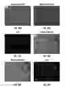 Fig. 45 - Chemotherapeutic compositions and methods for treating human gliomas