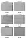 Fig. 49 - Chemotherapeutic compositions and methods for treating human gliomas