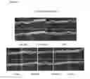 Fig. 22 - METHODS AND COMPOSITIONS FOR TREATING DISEASES, DISORDERS OR INJURY OF THE NERVOUS SYSTEM