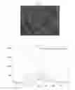 Fig. 28 - Long-acting injectable moxidectin formulations and novel moxidectin crystal forms