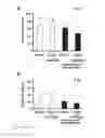 Fig. 03 - Method for treating glioblastomas and other tumors
