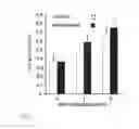 Fig. 04 - Method for treating glioblastomas and other tumors