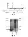 Fig. 07 - TRANSCRIPTOME WIRING ANALYSIS IN PARKINSON'S DISEASE AND USES THEREOF
