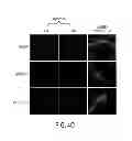Fig. 12 - TRANSCRIPTOME WIRING ANALYSIS IN PARKINSON'S DISEASE AND USES THEREOF