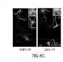 Fig. 20 - TRANSCRIPTOME WIRING ANALYSIS IN PARKINSON'S DISEASE AND USES THEREOF