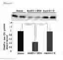 Fig. 04 - OLIGONUCLEOTIDE AND THERAPEUTIC AGENT FOR HYPERLIPIDEMIA CONTAINING SAME AS ACTIVE INGREDIENT