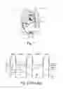 Fig. 02 - Cardiac pump with speed adapted for ventricle unloading