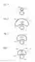 Fig. 04 - Vessel dissection and harvesting apparatus, systems and methods