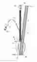 Fig. 04 - Laryngeal mask for use with an endoscope