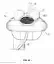 Fig. 14 - Laryngeal mask for use with an endoscope