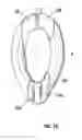 Fig. 17 - Laryngeal mask for use with an endoscope