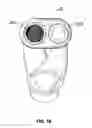 Fig. 19 - Laryngeal mask for use with an endoscope