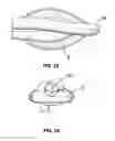 Fig. 23 - Laryngeal mask for use with an endoscope