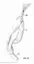 Fig. 26 - Laryngeal mask for use with an endoscope