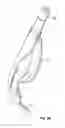 Fig. 27 - Laryngeal mask for use with an endoscope
