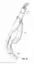 Fig. 28 - Laryngeal mask for use with an endoscope